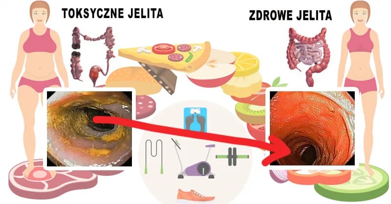 Jak odbudować jelita? 7 skutecznych sposobów na zdrowy mikrobiom