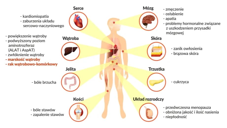 Hemochromatoza: 5 objawów skórnych, które musisz znać