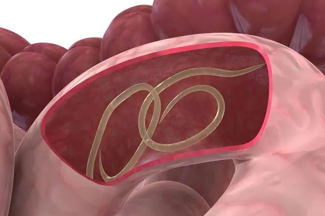 Niebezpieczne objawy glisty ludzkiej u dzieci. Jak rozpoznać i leczyć?